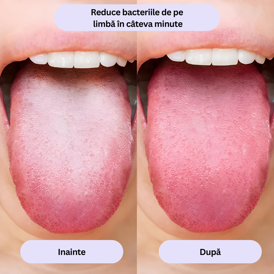 Spray oral pentru respirație