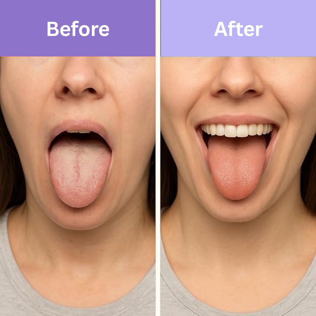 Dispozitiv de curatare pentru limba