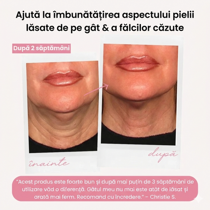 Crema de fermitate pentru gat